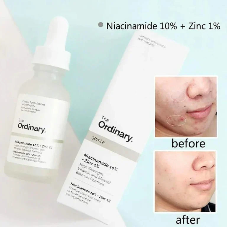 The Ordinary Niacinamide Serum – 10% Niacinamide + 1% Zinc – 30ml
